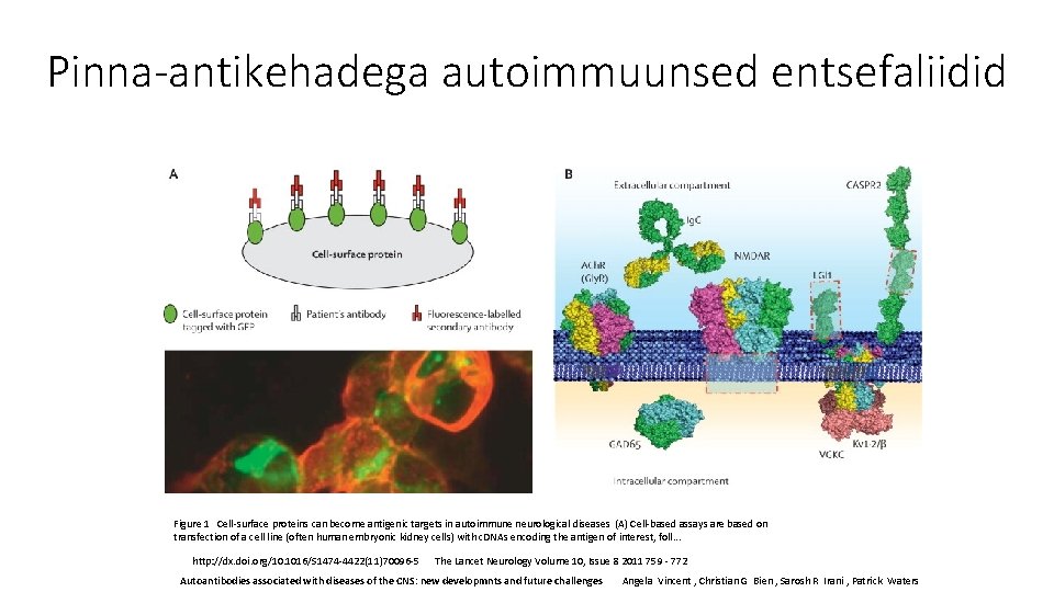 Pinna-antikehadega autoimmuunsed entsefaliidid Figure 1 Cell-surface proteins can become antigenic targets in autoimmune neurological