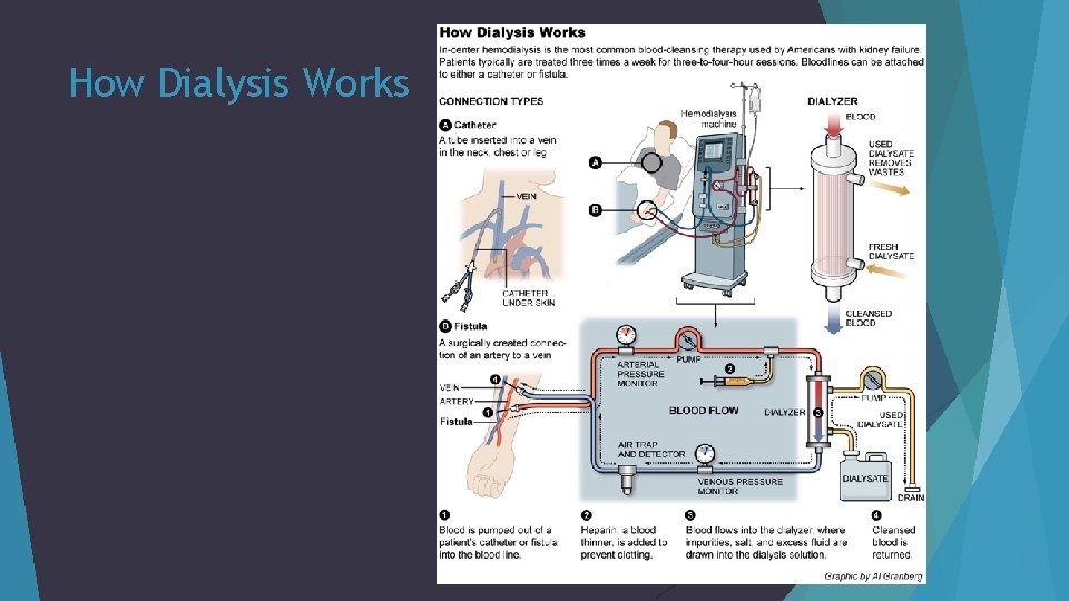 How Dialysis Works 