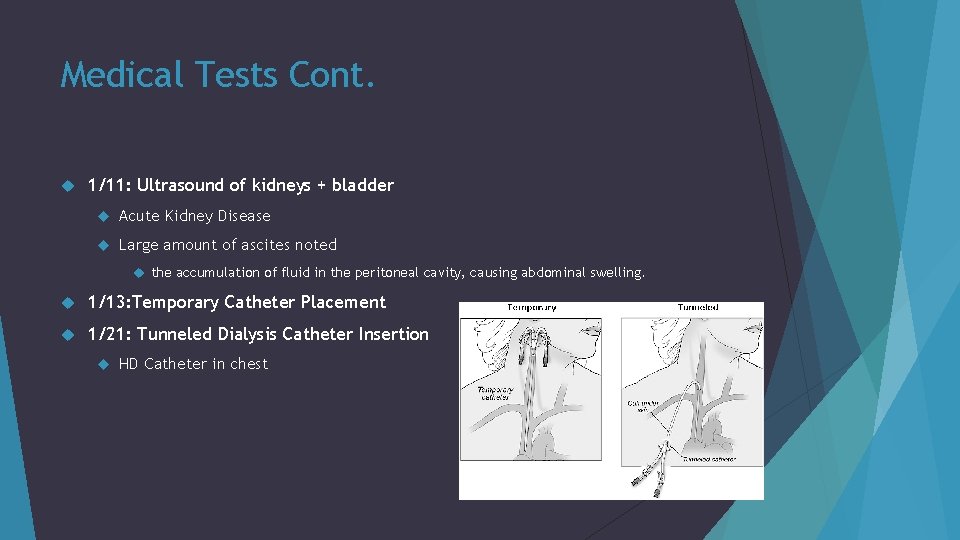 Medical Tests Cont. 1/11: Ultrasound of kidneys + bladder Acute Kidney Disease Large amount