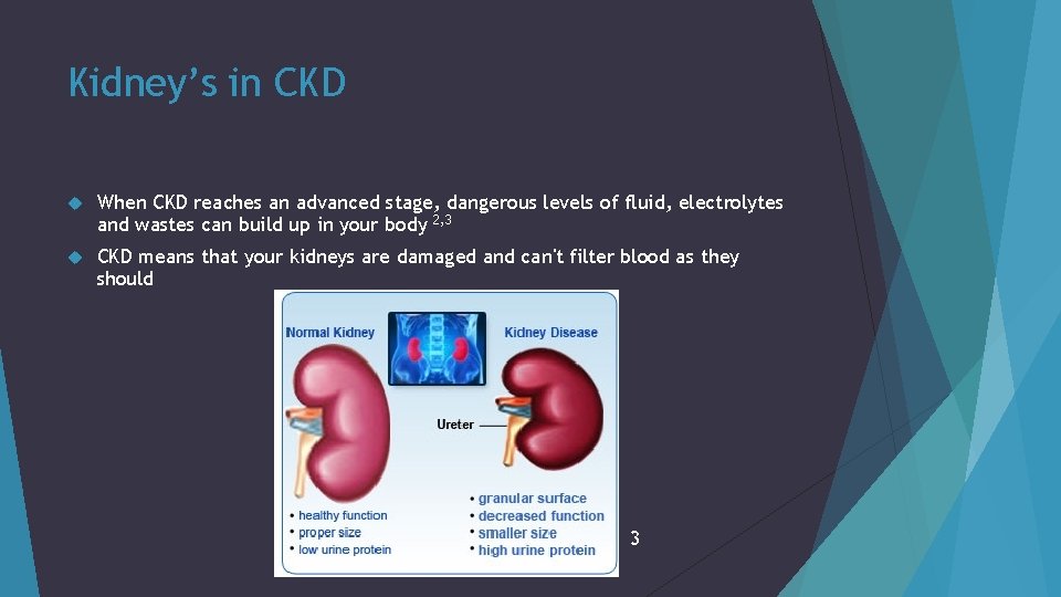 Kidney’s in CKD When CKD reaches an advanced stage, dangerous levels of fluid, electrolytes