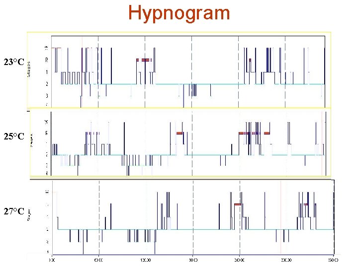 Hypnogram 23°C 25°C 27°C 