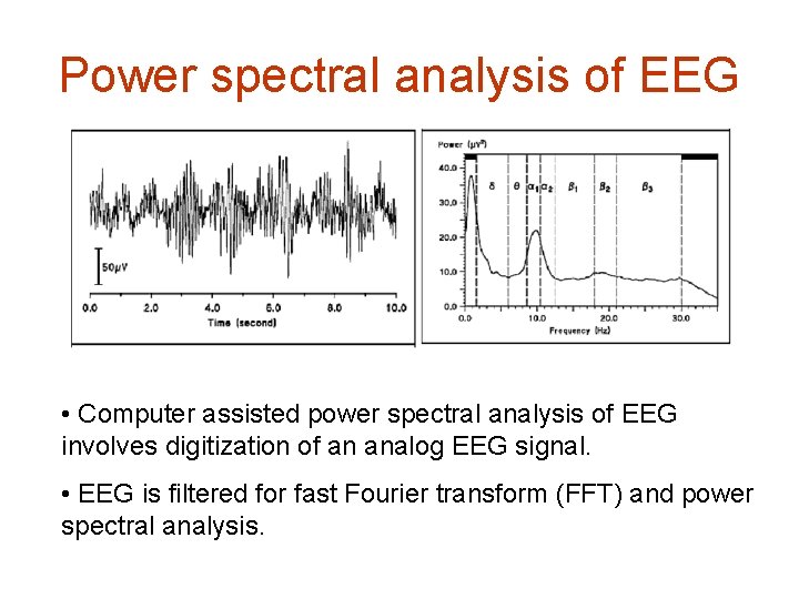 Power spectral analysis of EEG • Computer assisted power spectral analysis of EEG involves