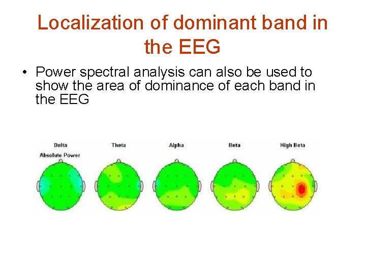 Localization of dominant band in the EEG • Power spectral analysis can also be