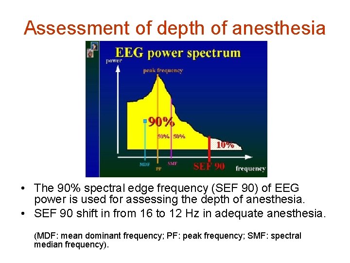 Assessment of depth of anesthesia • The 90% spectral edge frequency (SEF 90) of