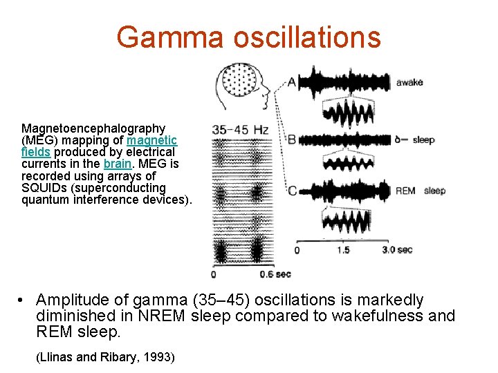 Gamma oscillations Magnetoencephalography (MEG) mapping of magnetic fields produced by electrical currents in the
