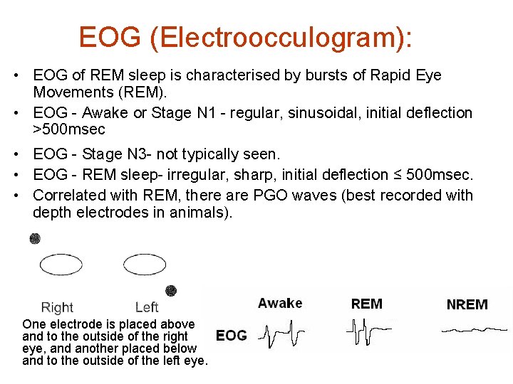 EOG (Electroocculogram): • EOG of REM sleep is characterised by bursts of Rapid Eye