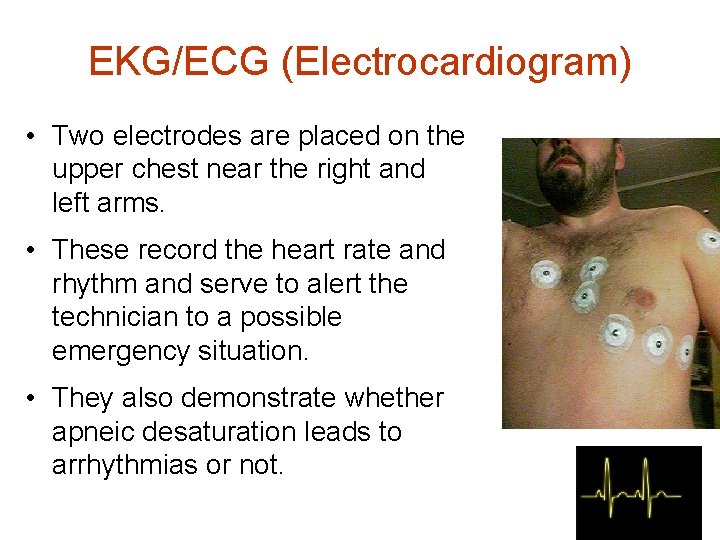 EKG/ECG (Electrocardiogram) • Two electrodes are placed on the upper chest near the right