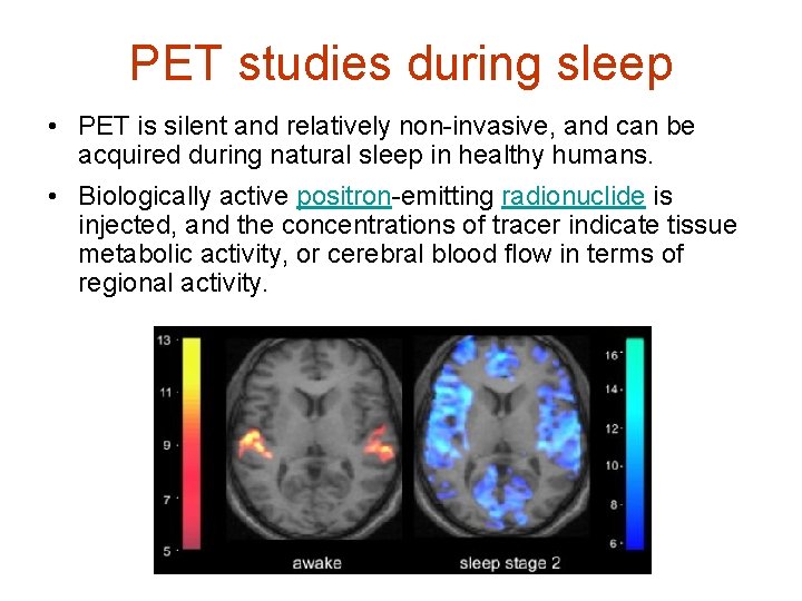 PET studies during sleep • PET is silent and relatively non-invasive, and can be