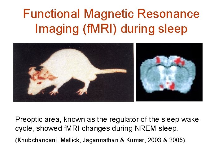 Functional Magnetic Resonance Imaging (f. MRI) during sleep Preoptic area, known as the regulator