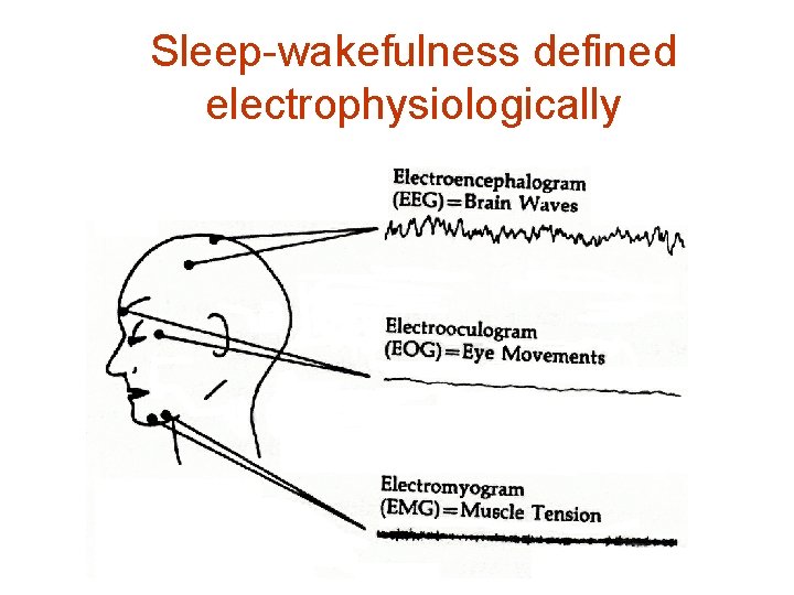 Sleep-wakefulness defined electrophysiologically 