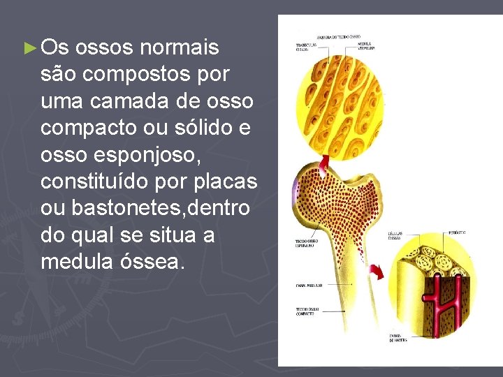 ► Os ossos normais são compostos por uma camada de osso compacto ou sólido