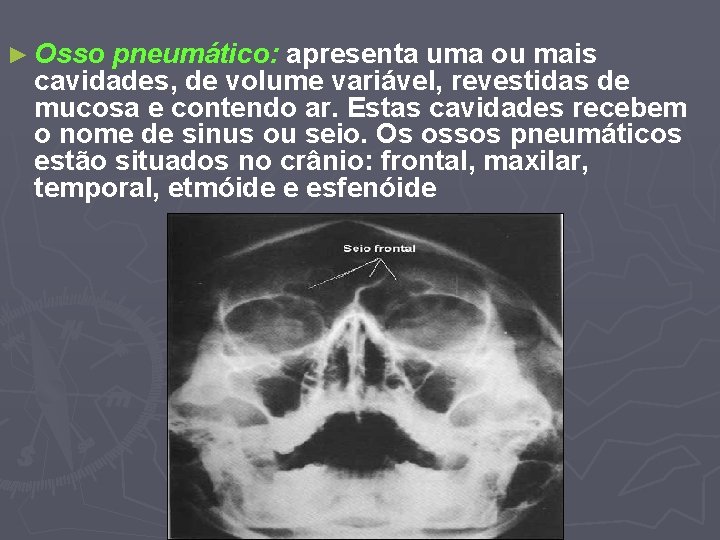 ► Osso pneumático: apresenta uma ou mais cavidades, de volume variável, revestidas de mucosa