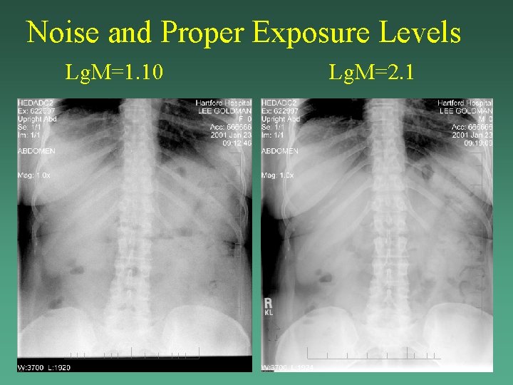Noise and Proper Exposure Levels Lg. M=1. 10 Lg. M=2. 1 Noise and Proper Exposure Levels Lg. M=1. 10 Lg. M=2. 1