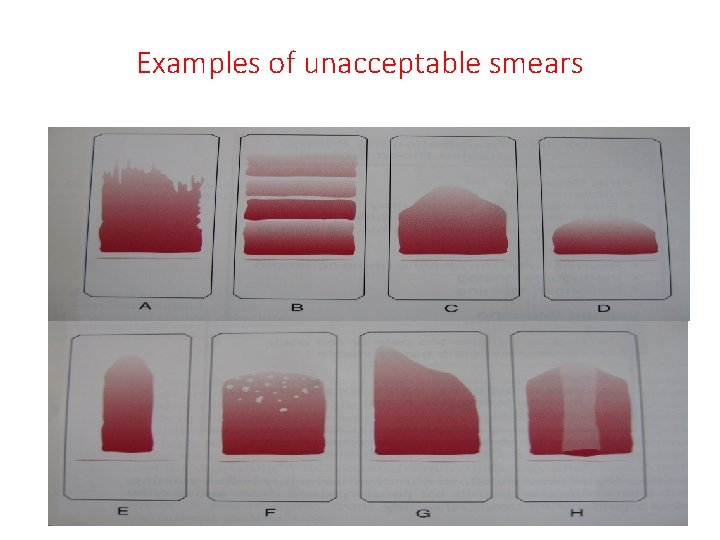 Examples of unacceptable smears 