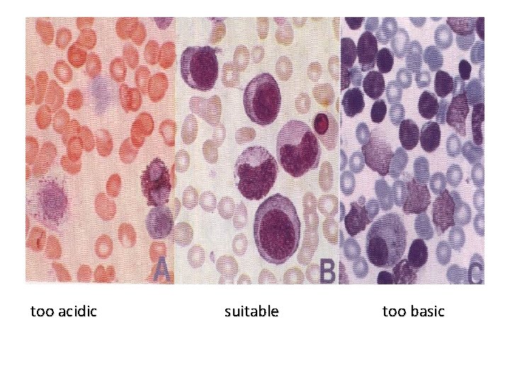 too acidic suitable too basic 