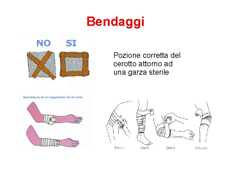 Bendaggi Pozione corretta del cerotto attorno ad una garza sterile 