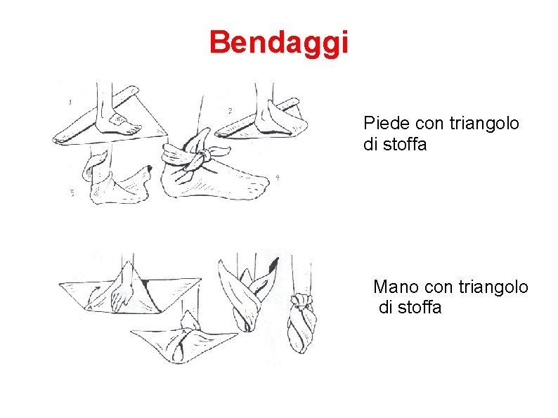 Bendaggi Piede con triangolo di stoffa Mano con triangolo di stoffa 