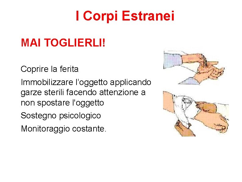 I Corpi Estranei MAI TOGLIERLI! Coprire la ferita Immobilizzare l’oggetto applicando garze sterili facendo