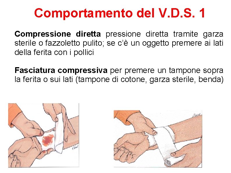 Comportamento del V. D. S. 1 Compressione diretta tramite garza sterile o fazzoletto pulito;