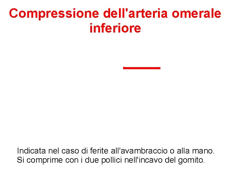 Compressione dell'arteria omerale inferiore Indicata nel caso di ferite all'avambraccio o alla mano. Si