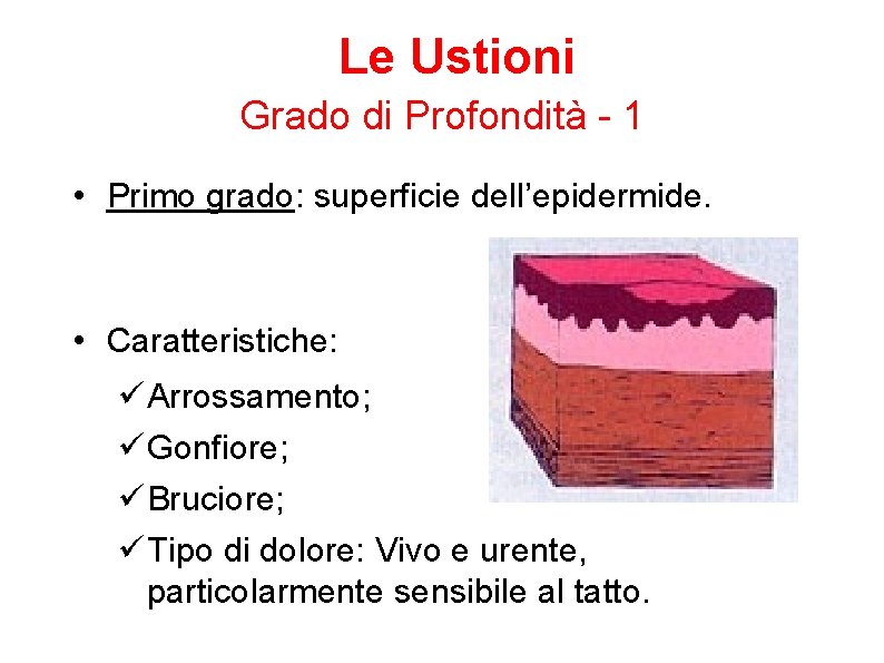 Le Ustioni Grado di Profondità - 1 • Primo grado: superficie dell’epidermide. • Caratteristiche: