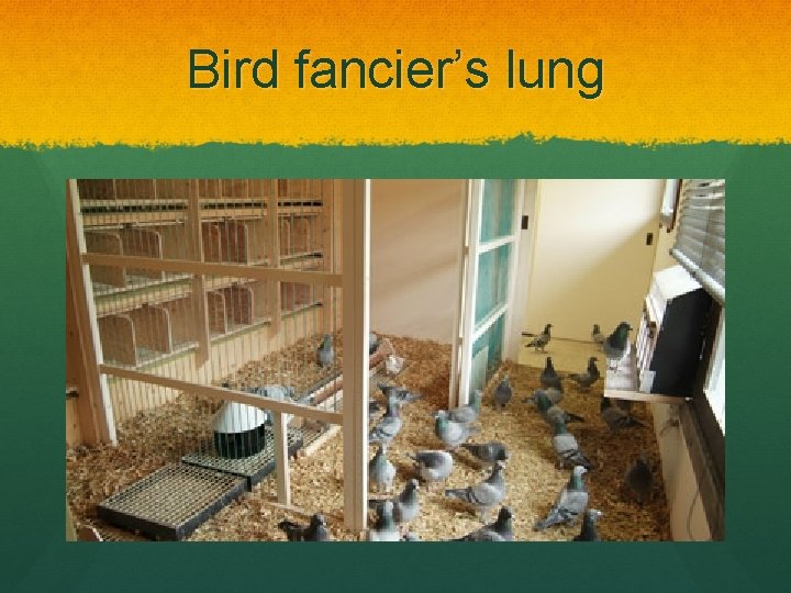 Bird fancier’s lung 