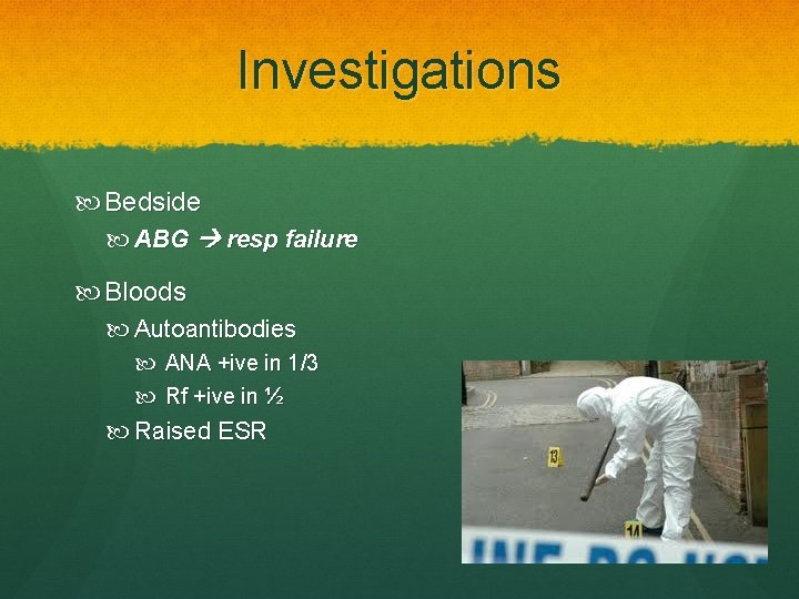 Investigations Bedside ABG resp failure Bloods Autoantibodies ANA +ive in 1/3 Rf +ive in