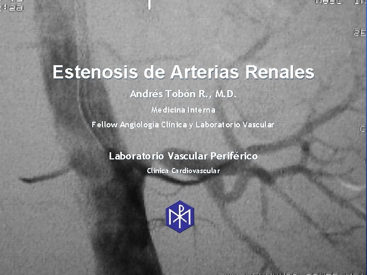 Estenosis de Arterias Renales Andrés Tobón R. , M. D. Medicina Interna Fellow Angiología