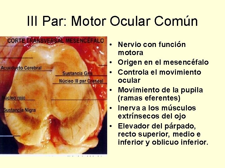 III Par: Motor Ocular Común • Nervio con función motora • Origen en el