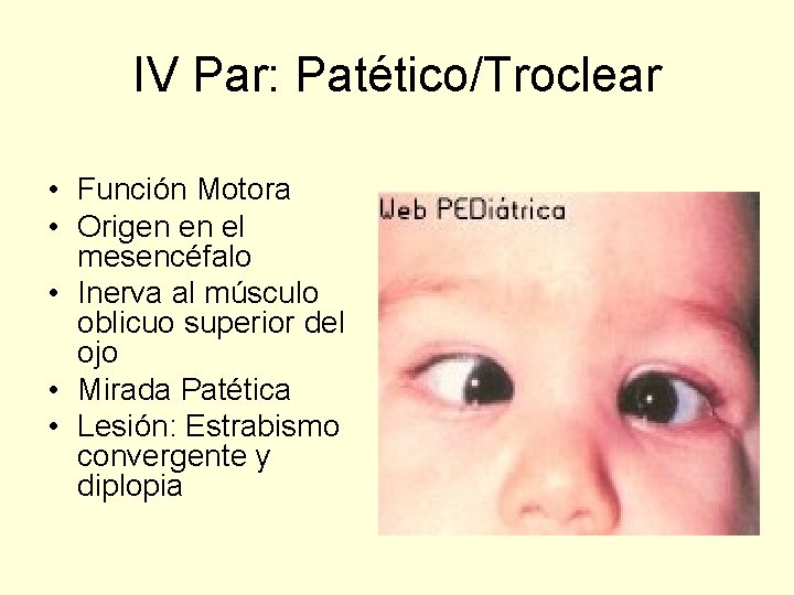IV Par: Patético/Troclear • Función Motora • Origen en el mesencéfalo • Inerva al