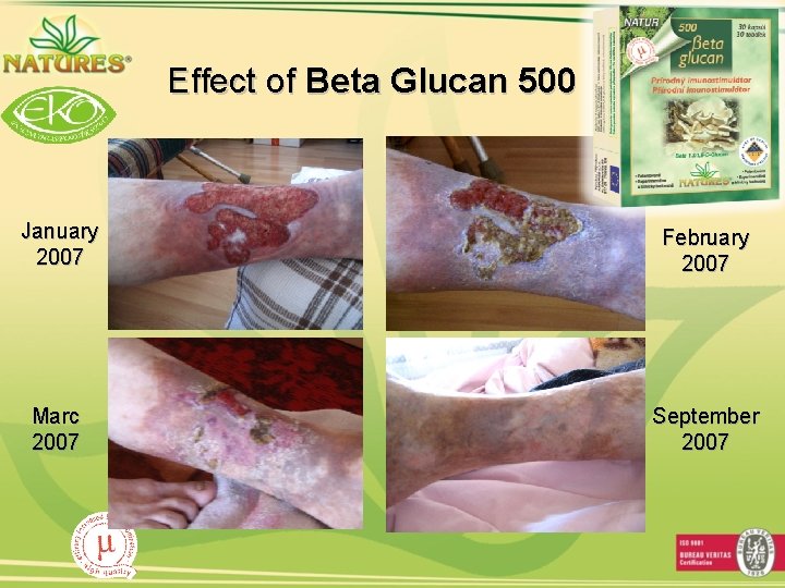 Effect of Beta Glucan 500 January 2007 February 2007 Marc 2007 September 2007 