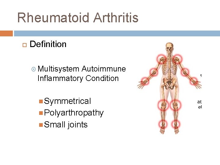 RHEUMATOID ARTHRITIS - Definiția și sinonimele rheumatoid arthritis în dicționarul Engleză