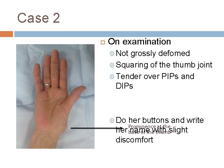 Case 2 On examination Not grossly defomed Squaring of the thumb joint Tender over