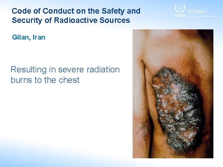 Code of Conduct on the Safety and Security of Radioactive Sources Gilan, Iran Resulting Code of Conduct on the Safety and Security of Radioactive Sources Gilan, Iran Resulting