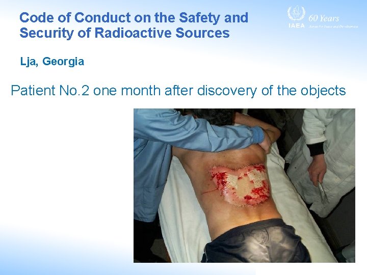 Code of Conduct on the Safety and Security of Radioactive Sources Lja, Georgia Patient Code of Conduct on the Safety and Security of Radioactive Sources Lja, Georgia Patient