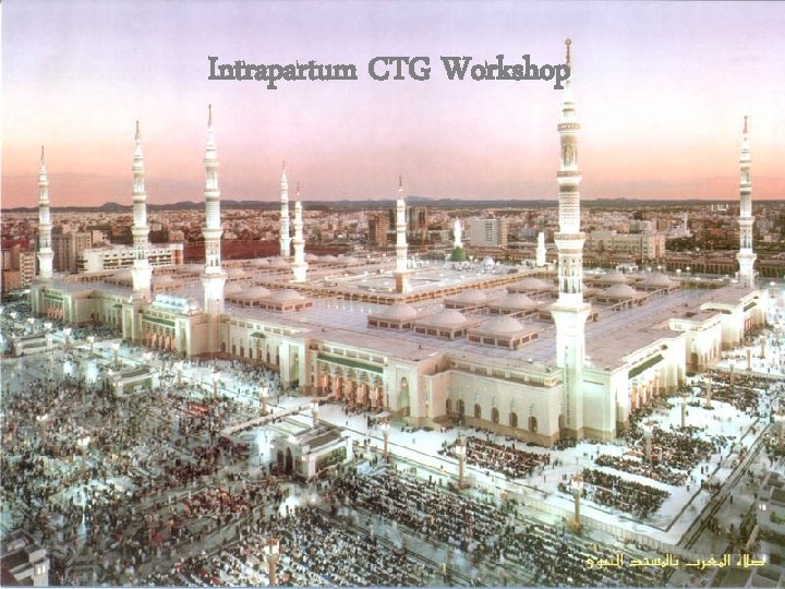 Intrapartum CTG Workshop Intrapartum CTG Workshop