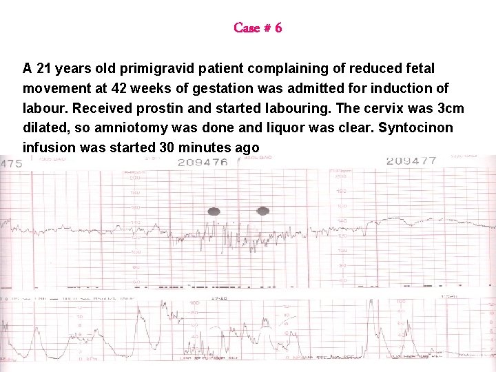 Case # 6 A 21 years old primigravid patient complaining of reduced fetal movement Case # 6 A 21 years old primigravid patient complaining of reduced fetal movement