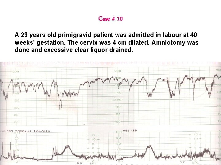 Case # 10 A 23 years old primigravid patient was admitted in labour at Case # 10 A 23 years old primigravid patient was admitted in labour at