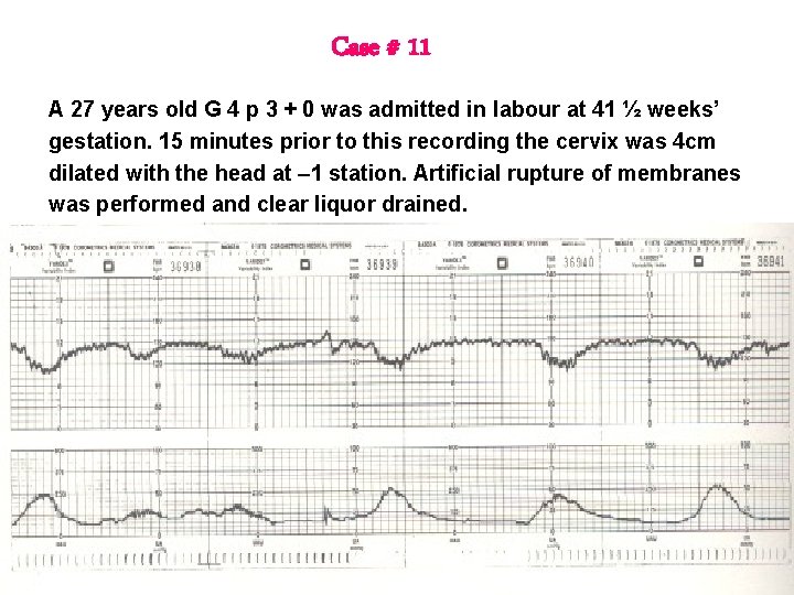 Case # 11 A 27 years old G 4 p 3 + 0 was Case # 11 A 27 years old G 4 p 3 + 0 was