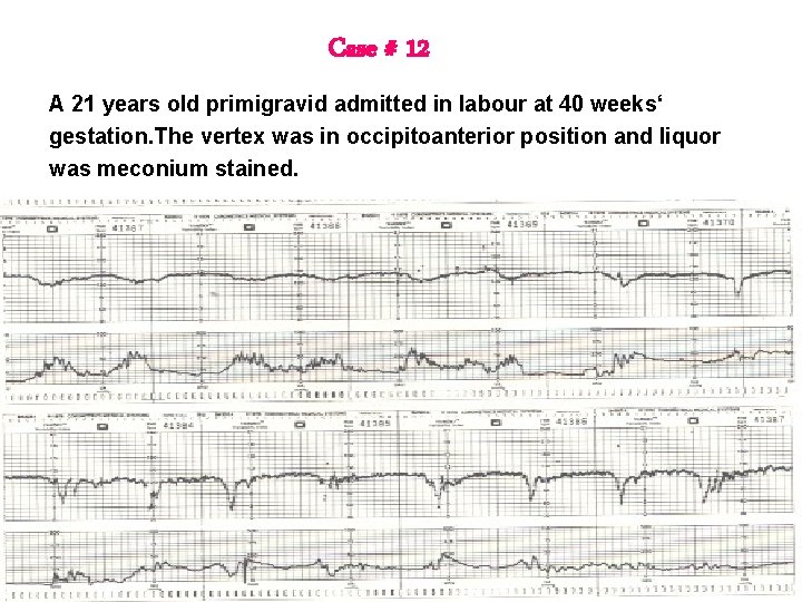Case # 12 A 21 years old primigravid admitted in labour at 40 weeks‘ Case # 12 A 21 years old primigravid admitted in labour at 40 weeks‘