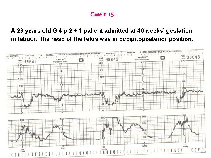 Case # 15 A 29 years old G 4 p 2 + 1 patient Case # 15 A 29 years old G 4 p 2 + 1 patient
