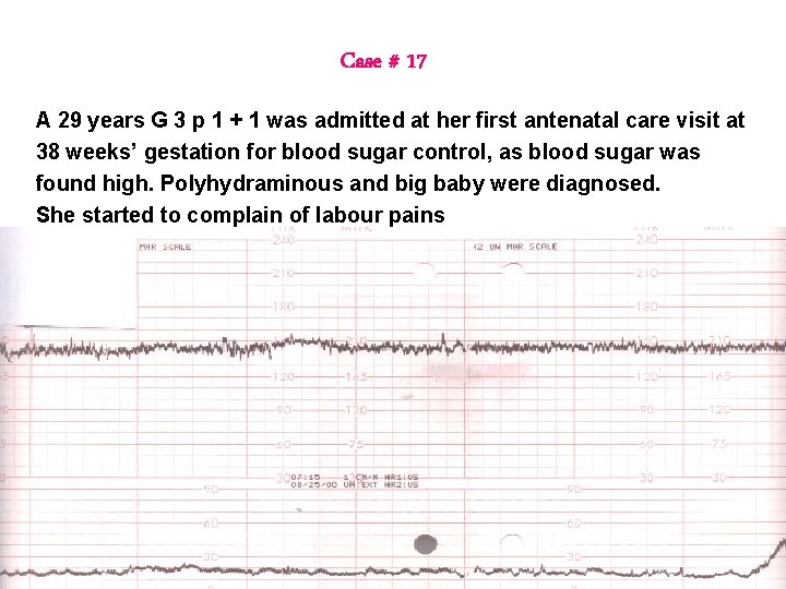 Case # 17 A 29 years G 3 p 1 + 1 was admitted Case # 17 A 29 years G 3 p 1 + 1 was admitted