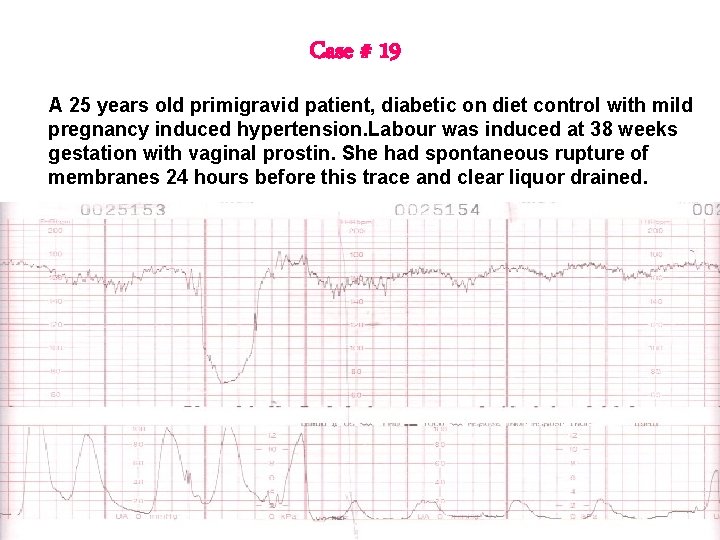 Case # 19 A 25 years old primigravid patient, diabetic on diet control with Case # 19 A 25 years old primigravid patient, diabetic on diet control with