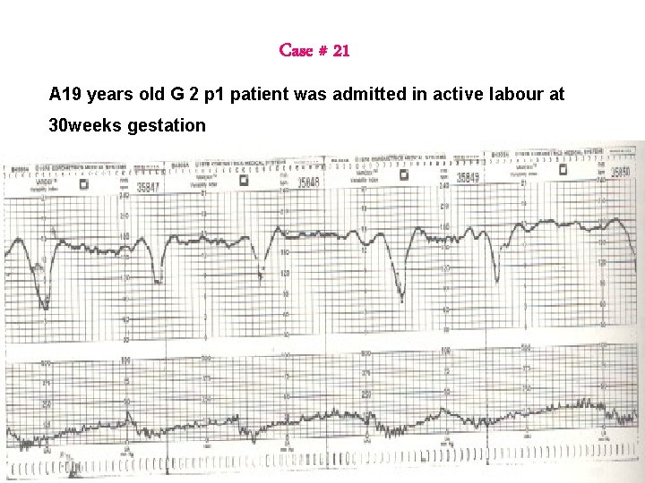 Case # 21 A 19 years old G 2 p 1 patient was admitted Case # 21 A 19 years old G 2 p 1 patient was admitted