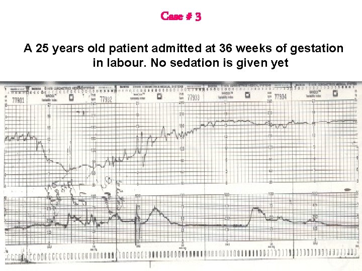 Case # 3 A 25 years old patient admitted at 36 weeks of gestation Case # 3 A 25 years old patient admitted at 36 weeks of gestation
