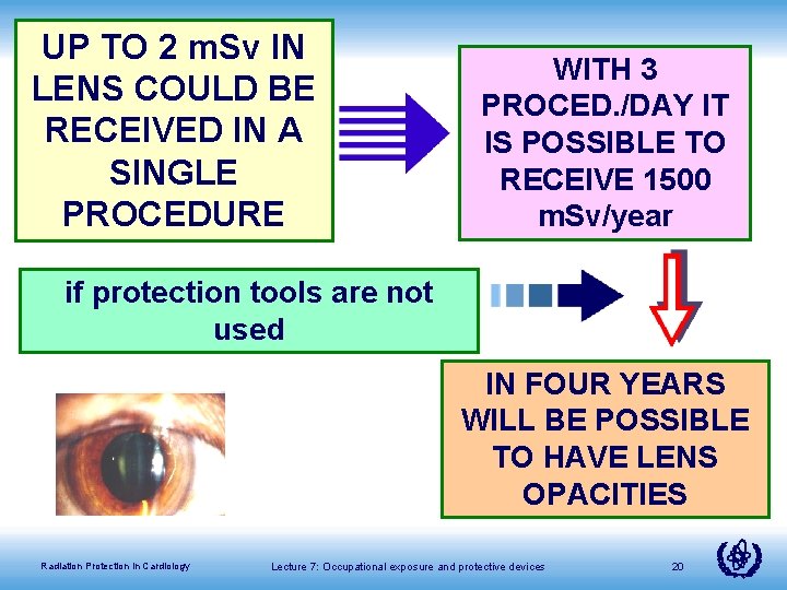 UP TO 2 m. Sv IN LENS COULD BE RECEIVED IN A SINGLE PROCEDURE