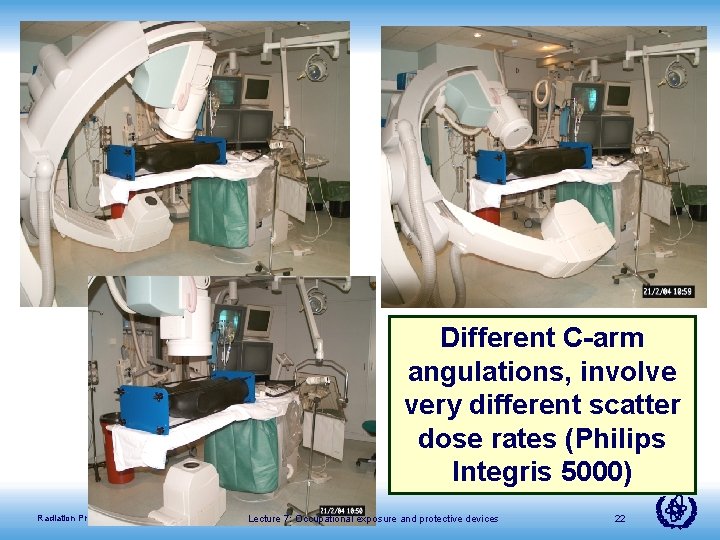 Different C-arm angulations, involve very different scatter dose rates (Philips Integris 5000) Radiation Protection