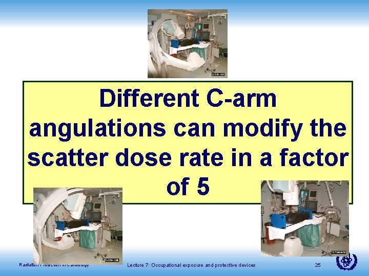 Different C-arm angulations can modify the scatter dose rate in a factor of 5