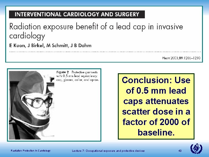 Conclusion: Use of 0. 5 mm lead caps attenuates scatter dose in a factor