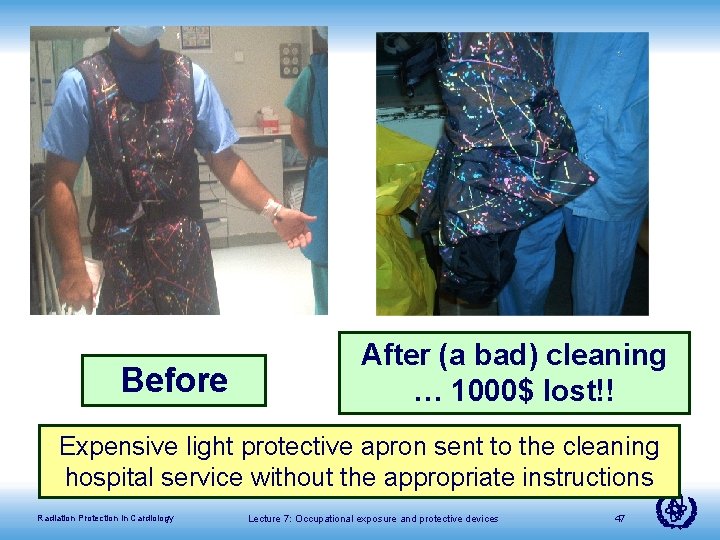 Before After (a bad) cleaning … 1000$ lost!! Expensive light protective apron sent to